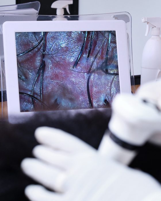 Diagnostic capillaire : une caméra grossissante affiche le cuir chevelu et les racines à l’écran